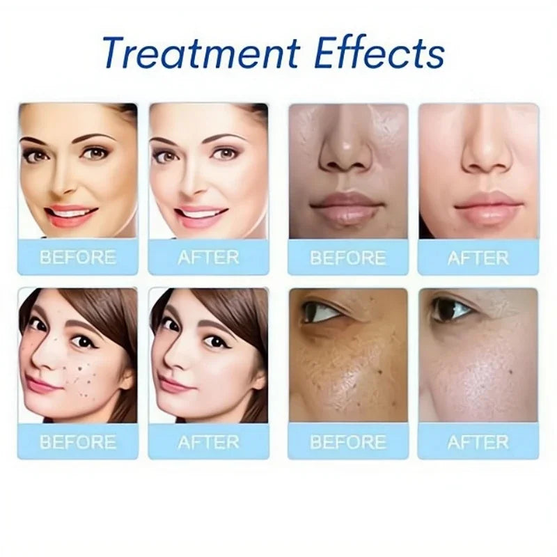 3Pcs/Set Serum Aqua Peel Solution Concentrated Solution Deep Clean Essence For Facial Skincare Hydro Dermabrasion Beauty Machine