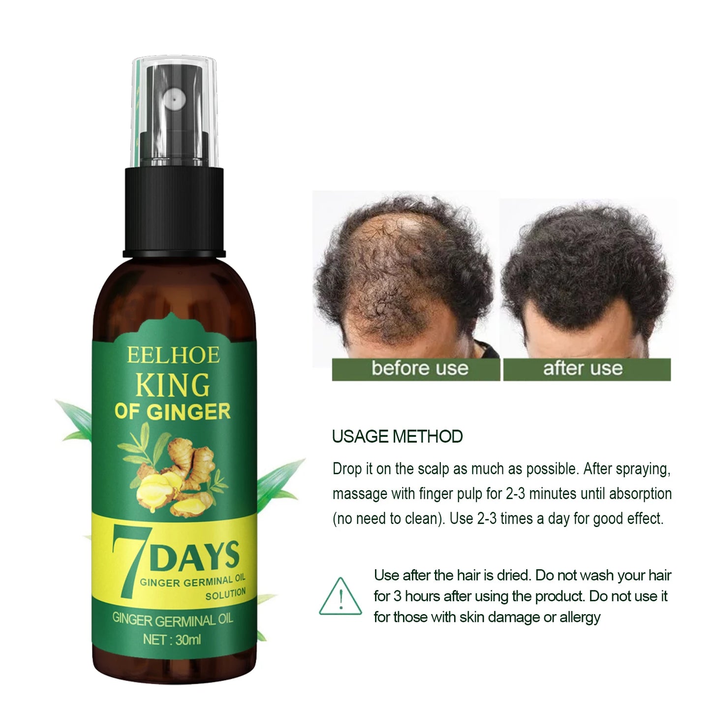 Ginger Care Hair Spray Hair Growth Essence Nourish Hair Roots Massag Scalp Repair Hair Quality Control Oil Hair Care Solution