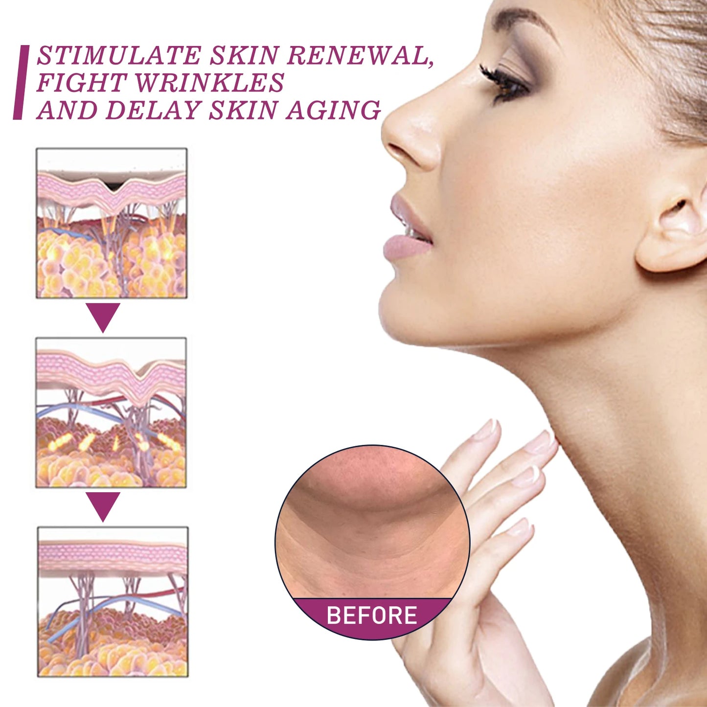Hydrolyzed Collagen Neck Cream Firming Lifting Eliminate Neck Fine Lines Neck Remove Double Chin Rejuvenation Cream SkinCare