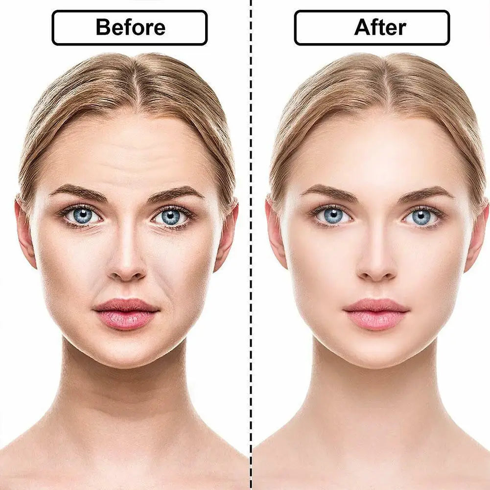 18Pcs Silicone Face Forehead Cheek Chin Sticker Anti-wrinkle Face Eye Patches Wrinkle Removal Face Lifting Beauty Tool Skin Care