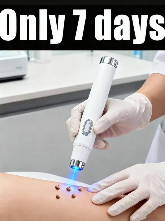 Warts Blue Light Tool, Easy To Clean Skin Care Tool