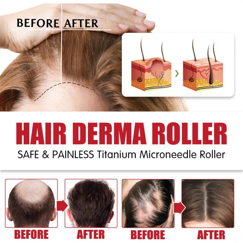 540 Micro Roller 0.25mm Titanium Alloy Micro Needle Derma Roller for Skin Rejuvenation, Hair Growth and Freckle Removal