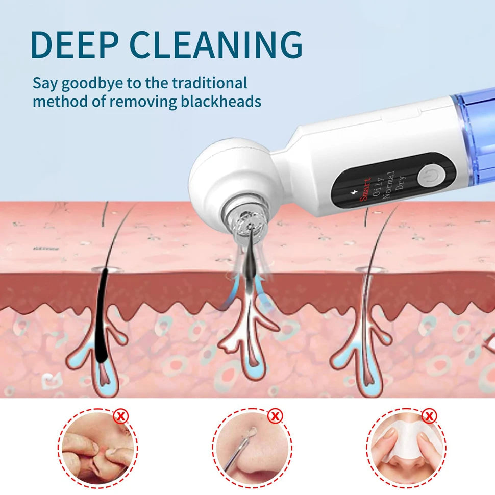 Hot Compress Blackhead Remover Skin Tag Remover Deep Dirt Skin Cleaning Machine with 6 Suction Heads Electric Beauty Device