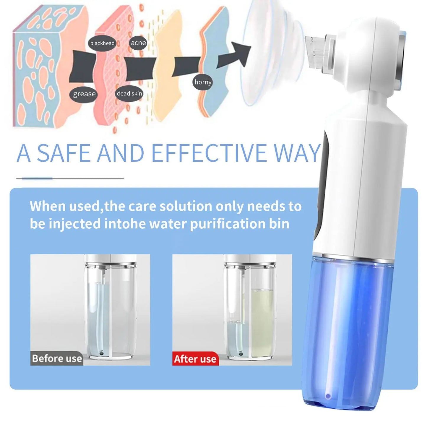 Hot Compress Blackhead Remover Skin Tag Remover Deep Dirt Skin Cleaning Machine with 6 Suction Heads Electric Beauty Device